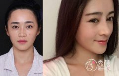 <b>国内谁修复鼻子好?刘彦军修复鼻子怎么样,技术靠谱吗?</b>