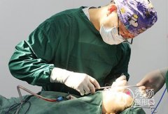 李劲良做鼻子好吗,北京李劲良做鼻子价格。