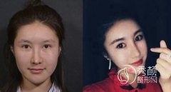 <b>李劲良有失败案例吗?</b>