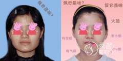 <b>上海九院下颌角谁做得好点,柴岗怎么样,案例。</b>