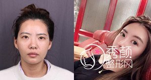 上海华美和九院哪个好,价格案例大对比。