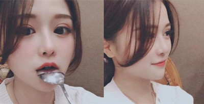 上海华美张朋鼻部手术+眼部手术案例。