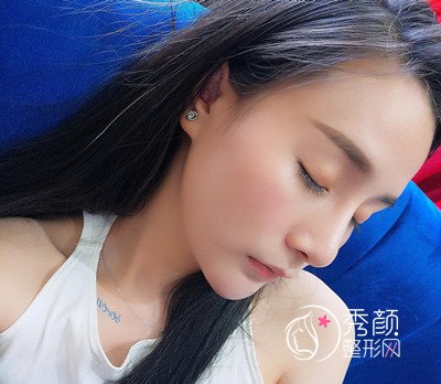 李志海削骨案例