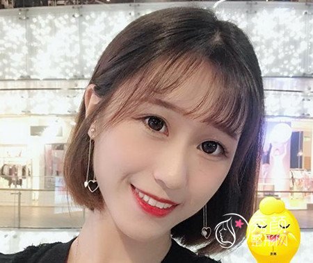 找乔爱军80000做的全脸脂肪填充,原来贵也有贵的道理啊。