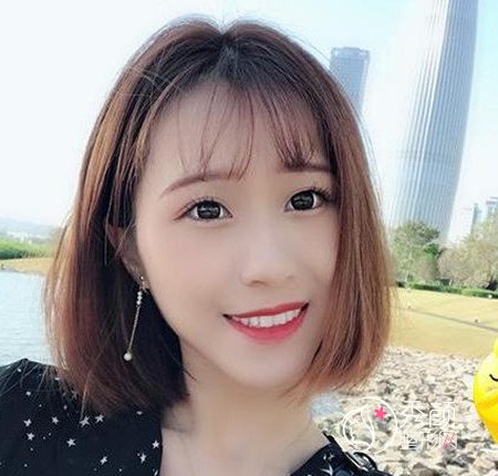 找乔爱军80000做的全脸脂肪填充,原来贵也有贵的道理啊。