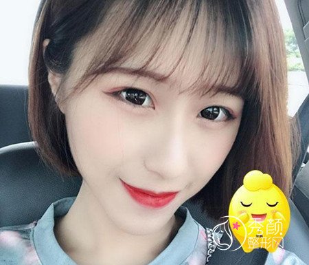 找乔爱军80000做的全脸脂肪填充,原来贵也有贵的道理啊。