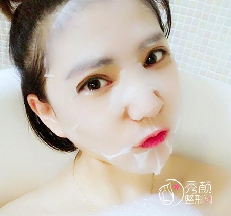 拒绝颧骨内推，上海首尔丽格金柱医生做了全脸填充。