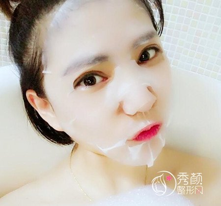 拒绝颧骨内推,上海首尔丽格金柱医生做了全脸填充。