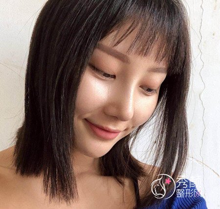 武汉杨权明给我做的鼻子惊艳了我,价格贵也不是问题。