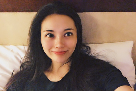 上海伊莱美李湘原割双眼皮+肋软骨隆鼻术前术后案例分享。