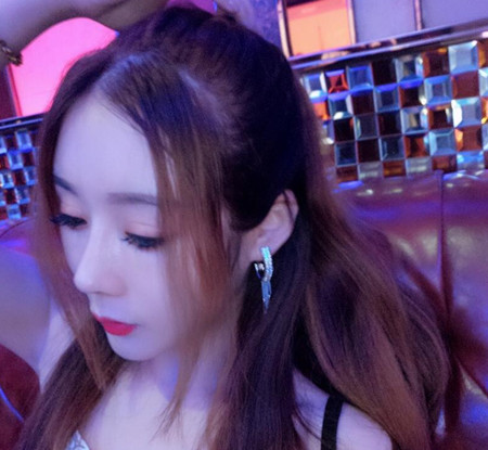 北京八大处王欢鼻修复案例。