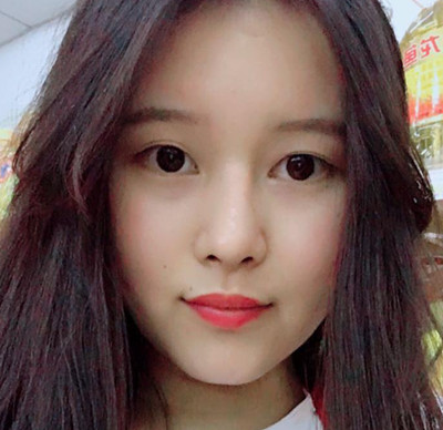鼻部整形医生欧阳春隆鼻案例。