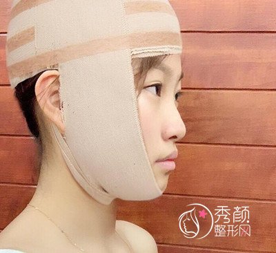 北京加减美面部提升案例，年轻不止10岁哦。