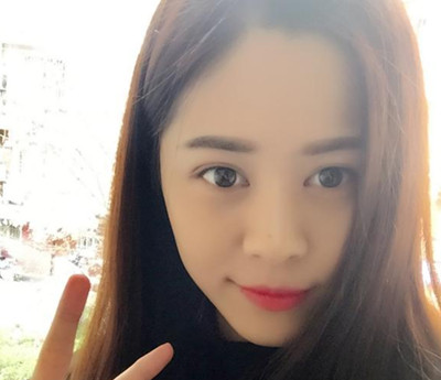 在江苏南京施尔美做的双眼皮开眼角，颜值提升了不止一点点。
