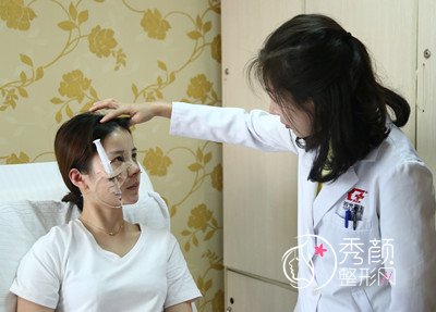 上海时光整形外科医院做的鼻部手术手术，感谢医美的存在。