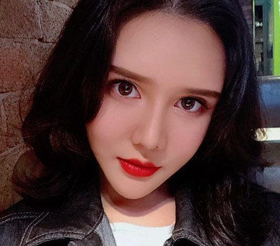 北京禾美嘉任学会自体脂肪面部填充案例过程分享。