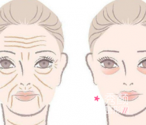 北京面部提升哪家医院好,祝东升和李晓东哪个医生好?