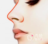 <b>做鼻子修复,刘波和牛勇敢哪个技术好,靠谱?</b>