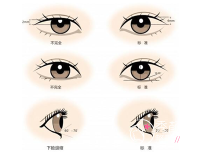 上海哪个医生修复双眼皮好,杨亚益、杜园园、徐晓斐、苏薇洁。