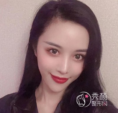 曝光我在北京禾美嘉任学会做全脸自体脂肪填充全过程。