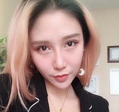 北京吸脂哪儿好,围观我在北京八大处做的面部吸脂案例吧。
