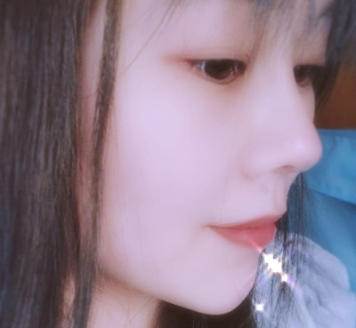 上海九院奥美定取出+肋软骨隆鼻+苹果肌填充案例。