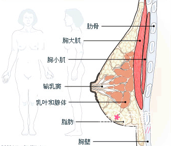 人工韧带乳房提升果怎么样,大概需要多少钱?