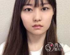 <b>金一秀磨骨怎么样,金一秀磨骨案例。</b>