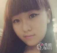 南京医科大友谊医院吴国平磨骨案例分享。
