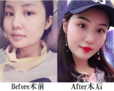 <b>上海金一秀磨骨怎么样?有没有失败案例?</b>