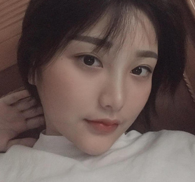 上海首尔丽格颧骨内推怎么样,看崔荣达给我做的脸型。