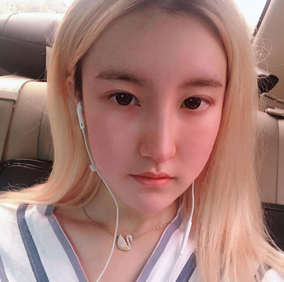 青岛华颜美孙好杰鼻部手术隆鼻术后5个月案例。