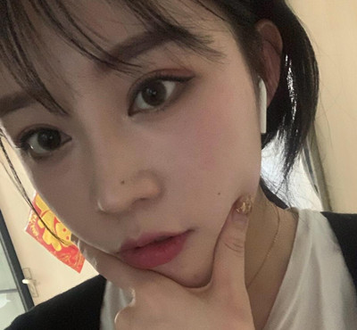 北京米扬丽格巫文云膨体+鼻中隔鼻修复案例。