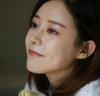 北京米扬丽格巫文云膨体+鼻中隔鼻修复案例。