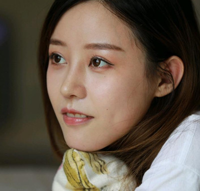 北京米扬丽格巫文云膨体+鼻中隔鼻修复案例。