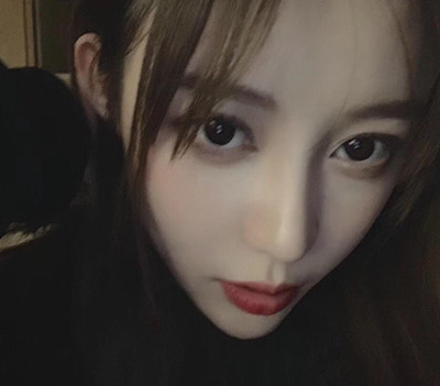 北京米扬丽格巫文云膨体+鼻中隔鼻修复案例。