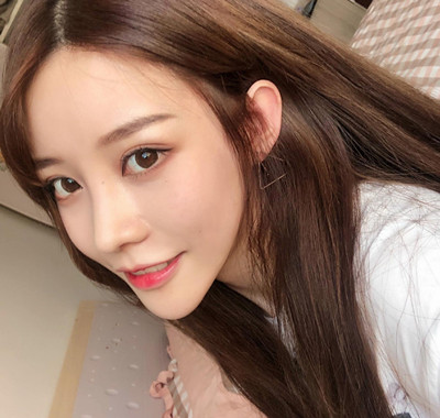 北京米扬丽格巫文云膨体+鼻中隔鼻修复案例。