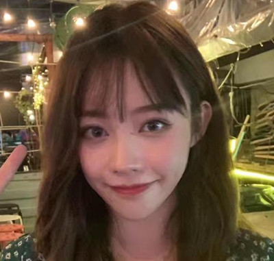 北京米扬丽格巫文云膨体+鼻中隔鼻修复案例。