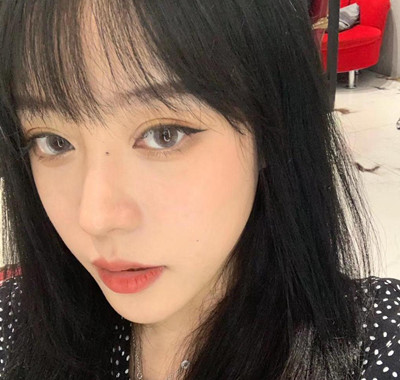 北京米扬丽格巫文云膨体+鼻中隔鼻修复案例。