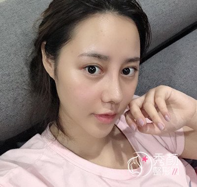 南京华美曹海峰做的鼻部手术怎么样