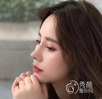 南京华美曹海峰做的鼻部手术怎么样