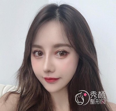 南京华美曹海峰做的鼻部手术怎么样