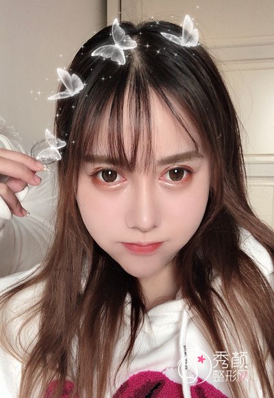 南京华美曹海峰做的鼻部手术怎么样
