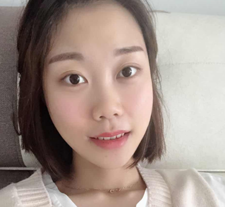 武汉磨骨手术经历分享~~~~~磨骨术前术后对比照