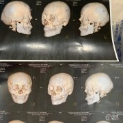 <b>穆雄铮磨骨怎么样,穆雄铮和俞良钢哪个好</b>
