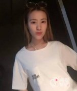 偏颌正颌手术两个月 术前术后对比