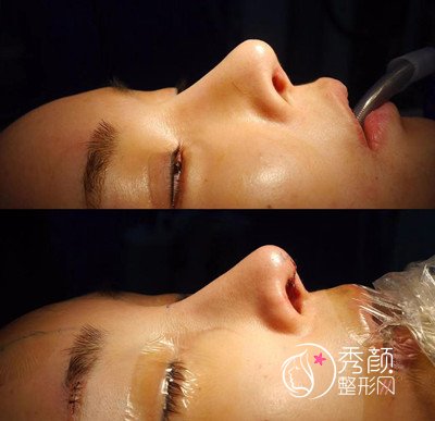 西安国际医学中心医院师俊莉做鼻子怎么样，技术审美风格好么？