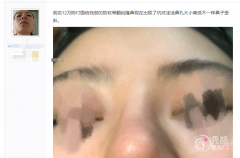 <b>上海九院陈付国隆鼻怎么样,失败案例是不是很多?</b>