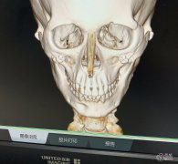 <b>听说张柱允磨骨技术很差?是否该避雷?</b>