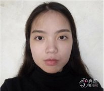 重庆姜民范磨骨技术怎么样啊,有没有失败案例?